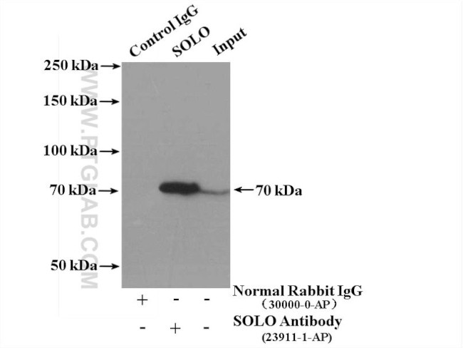 SOLO Antibody in Immunoprecipitation (IP)