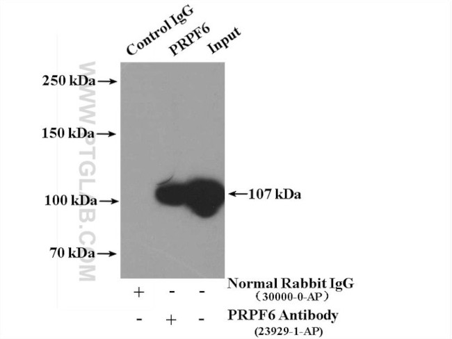PRPF6 Antibody in Immunoprecipitation (IP)