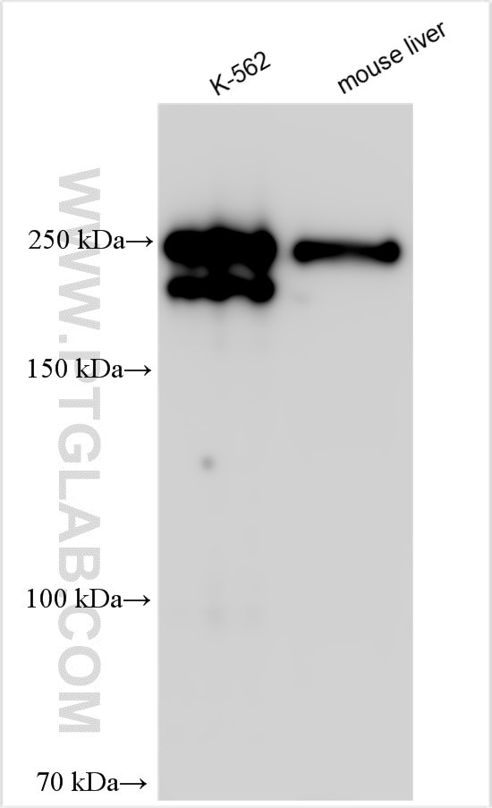 ANK1 Antibody in Western Blot (WB)