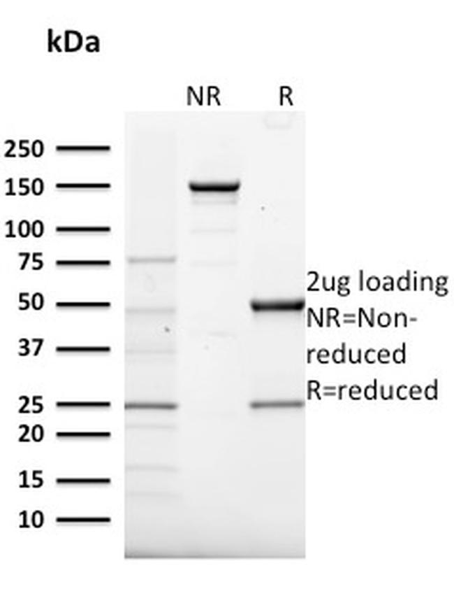 Frataxin Antibody in SDS-PAGE (SDS-PAGE)