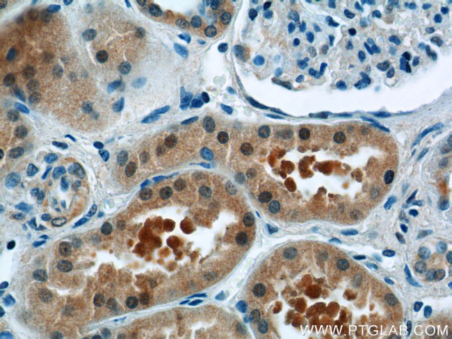 ZBTB20 Antibody in Immunohistochemistry (Paraffin) (IHC (P))