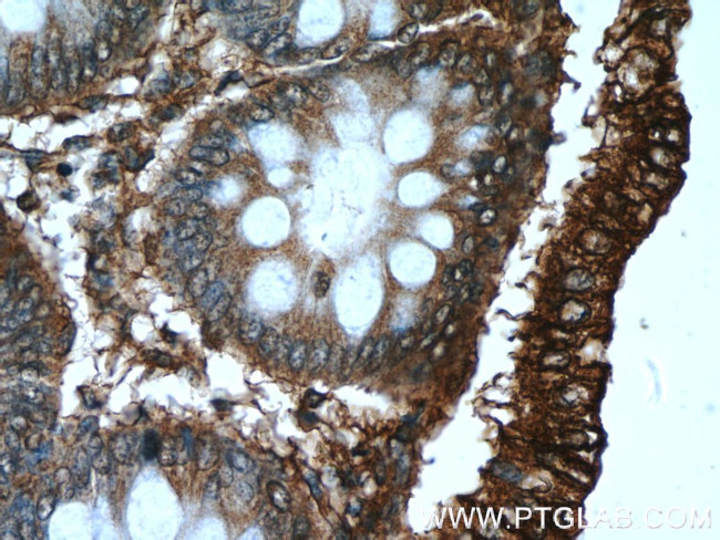 B4GALNT2 Antibody in Immunohistochemistry (Paraffin) (IHC (P))