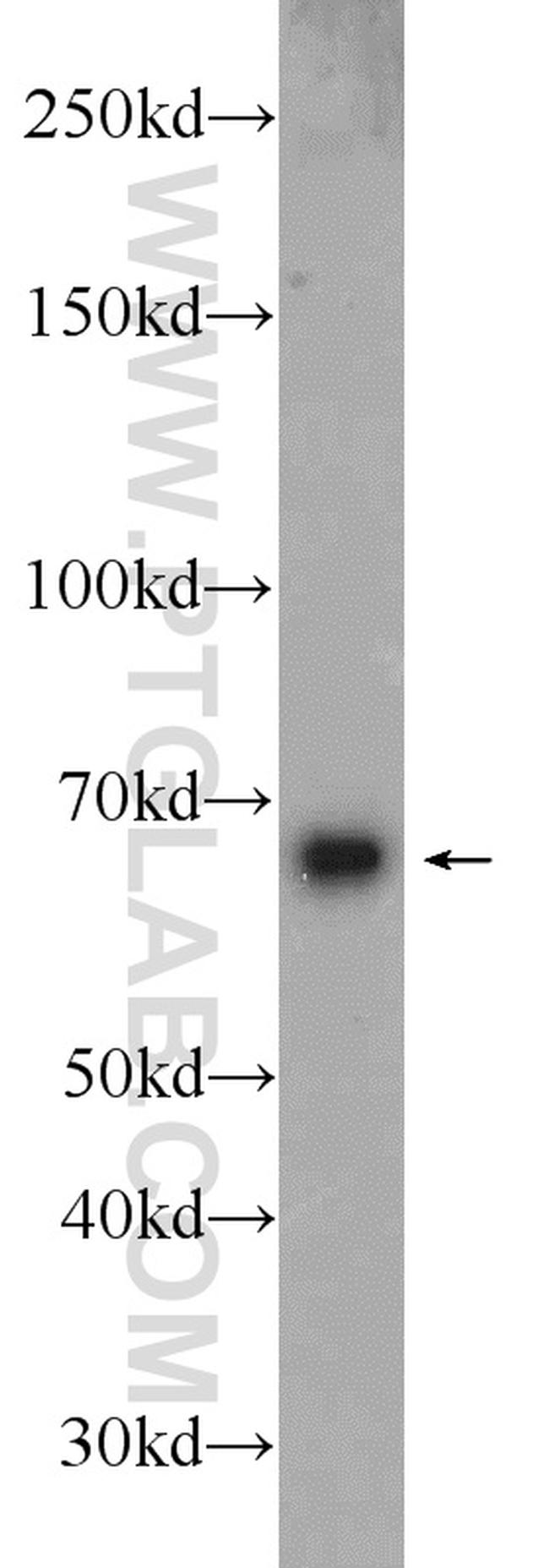 B4GALNT2 Antibody in Western Blot (WB)