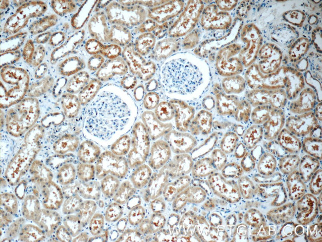 HSN2 Antibody in Immunohistochemistry (Paraffin) (IHC (P))