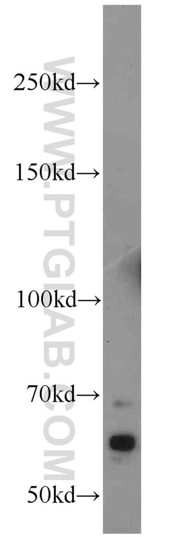 HSN2 Antibody in Western Blot (WB)