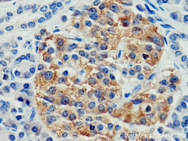 CEP120 Antibody in Immunohistochemistry (Paraffin) (IHC (P))
