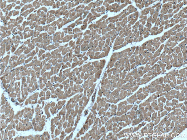 HACE1 Antibody in Immunohistochemistry (Paraffin) (IHC (P))