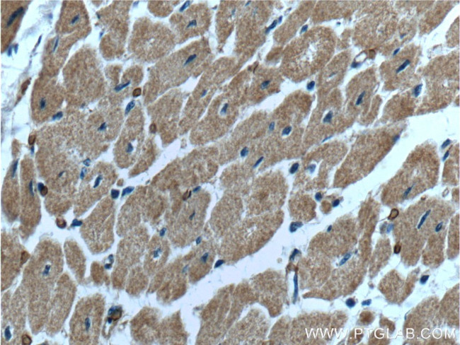 HACE1 Antibody in Immunohistochemistry (Paraffin) (IHC (P))