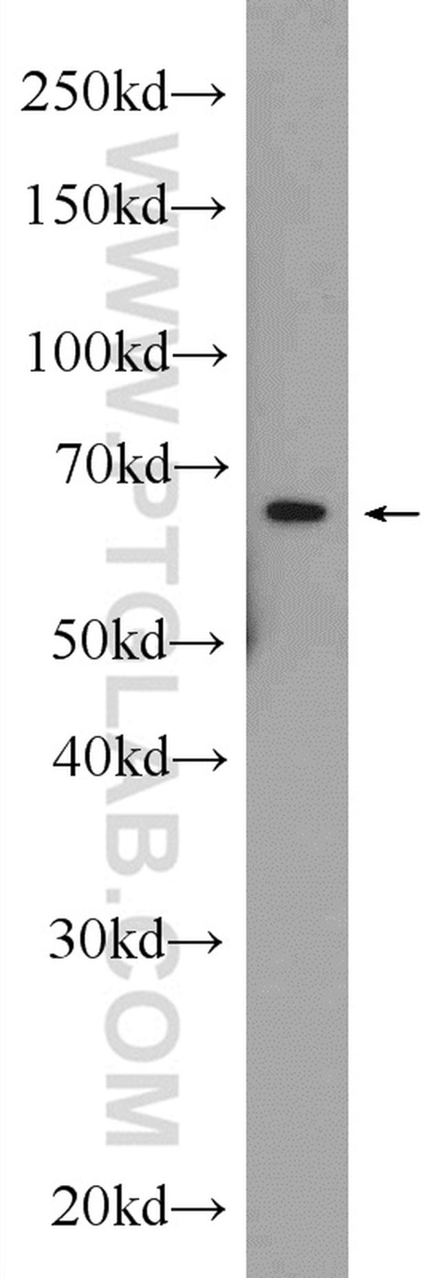 HACE1 Antibody in Western Blot (WB)