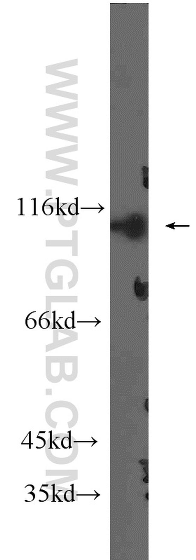 HACE1 Antibody in Western Blot (WB)