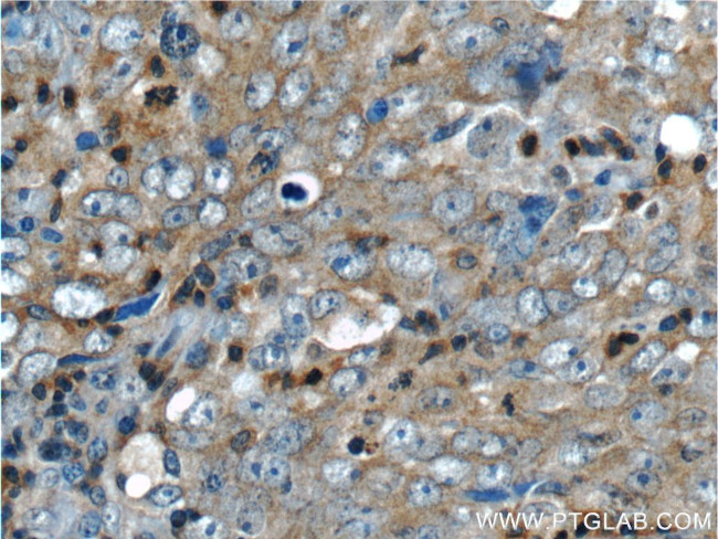 NEK2 Antibody in Immunohistochemistry (Paraffin) (IHC (P))