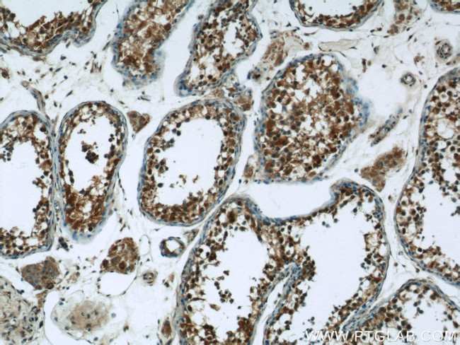 NEK2 Antibody in Immunohistochemistry (Paraffin) (IHC (P))