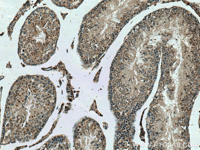 NEK2 Antibody in Immunohistochemistry (Paraffin) (IHC (P))