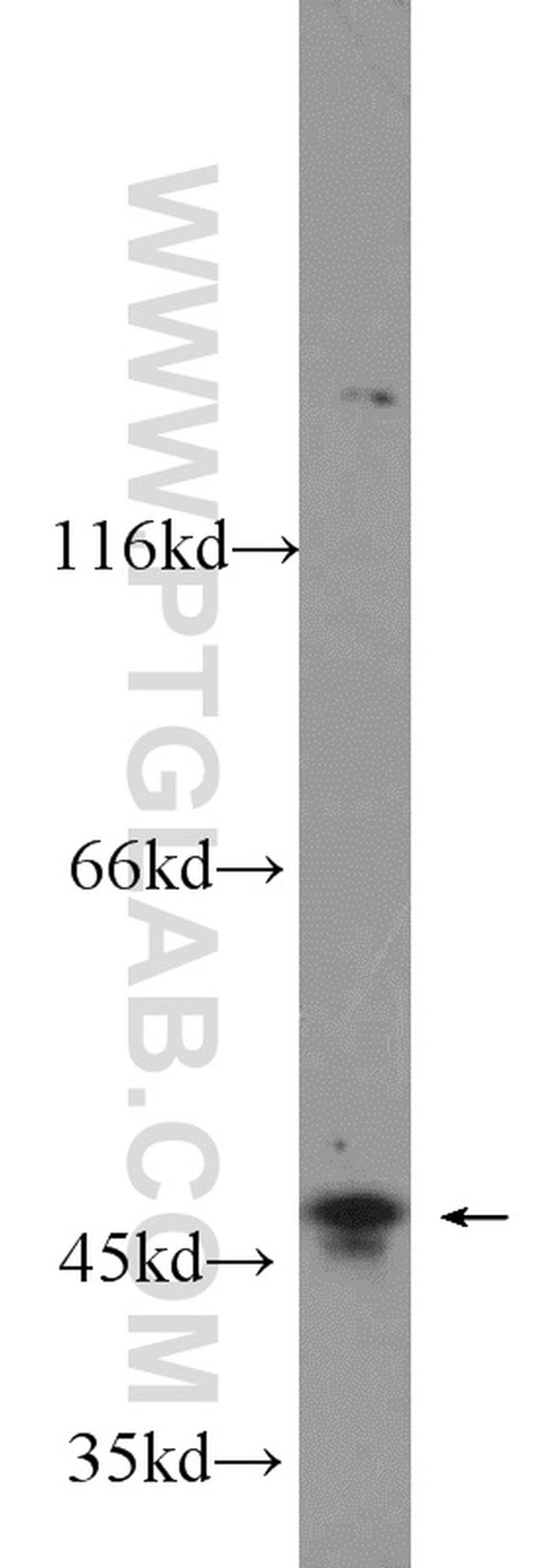 NEK2 Antibody in Western Blot (WB)