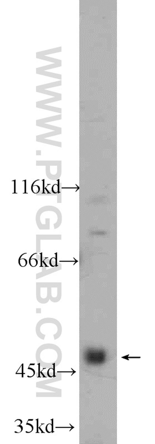 NEK2 Antibody in Western Blot (WB)