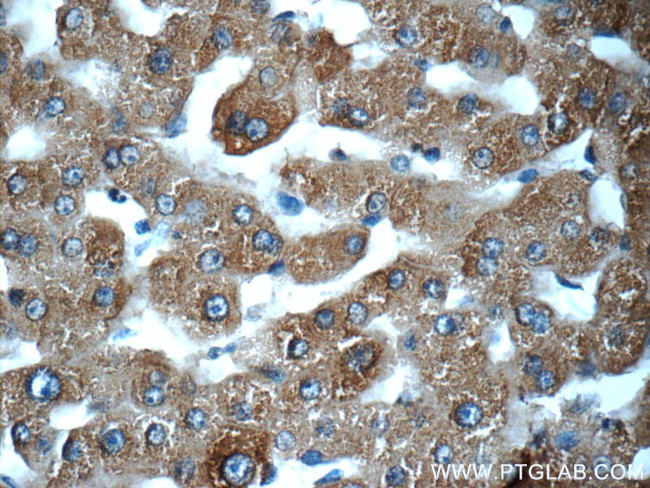 MBL2 Antibody in Immunohistochemistry (Paraffin) (IHC (P))