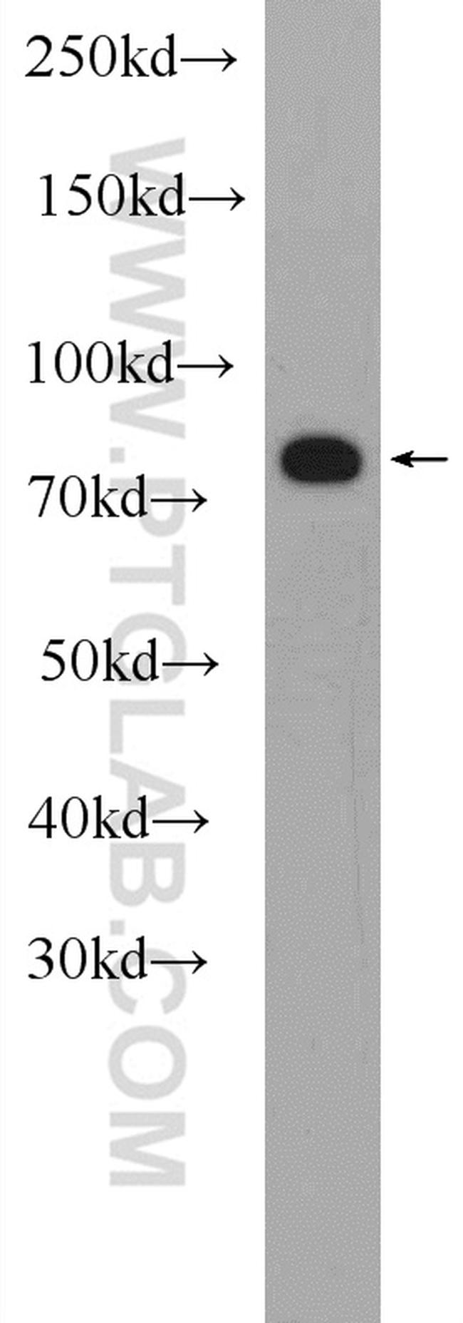 MEFV Antibody in Western Blot (WB)