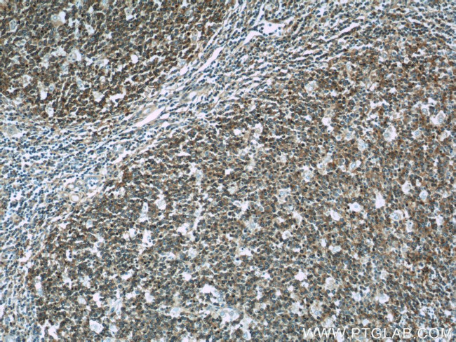 RFTN1 Antibody in Immunohistochemistry (Paraffin) (IHC (P))