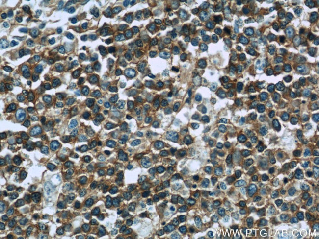 RFTN1 Antibody in Immunohistochemistry (Paraffin) (IHC (P))