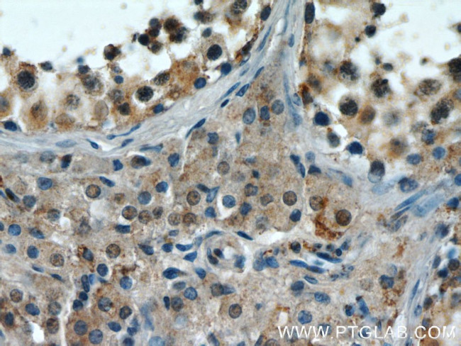 EFCAB5 Antibody in Immunohistochemistry (Paraffin) (IHC (P))