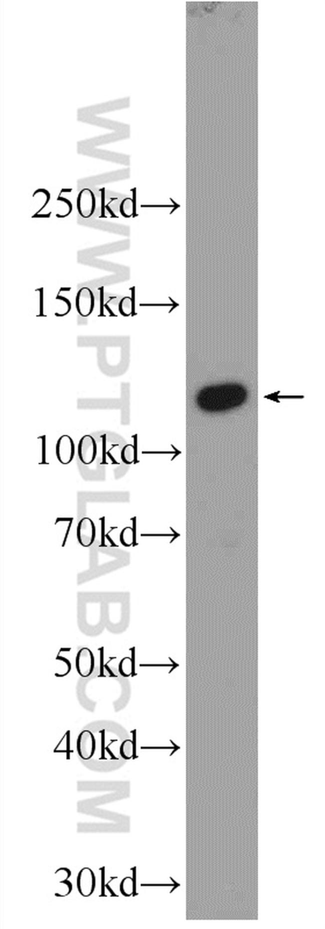 EFCAB5 Antibody in Western Blot (WB)