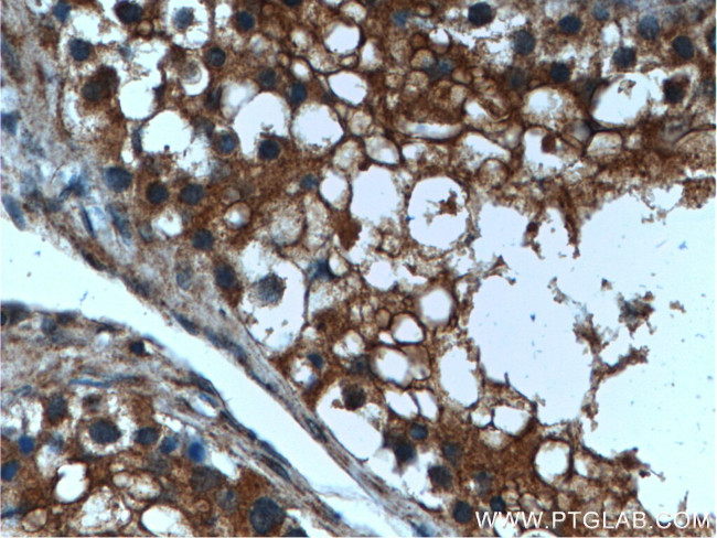 LIPI Antibody in Immunohistochemistry (Paraffin) (IHC (P))