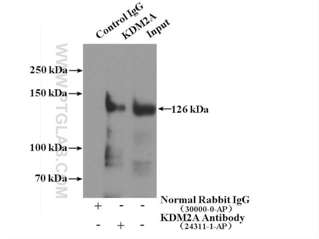 KDM2A Antibody in Immunoprecipitation (IP)