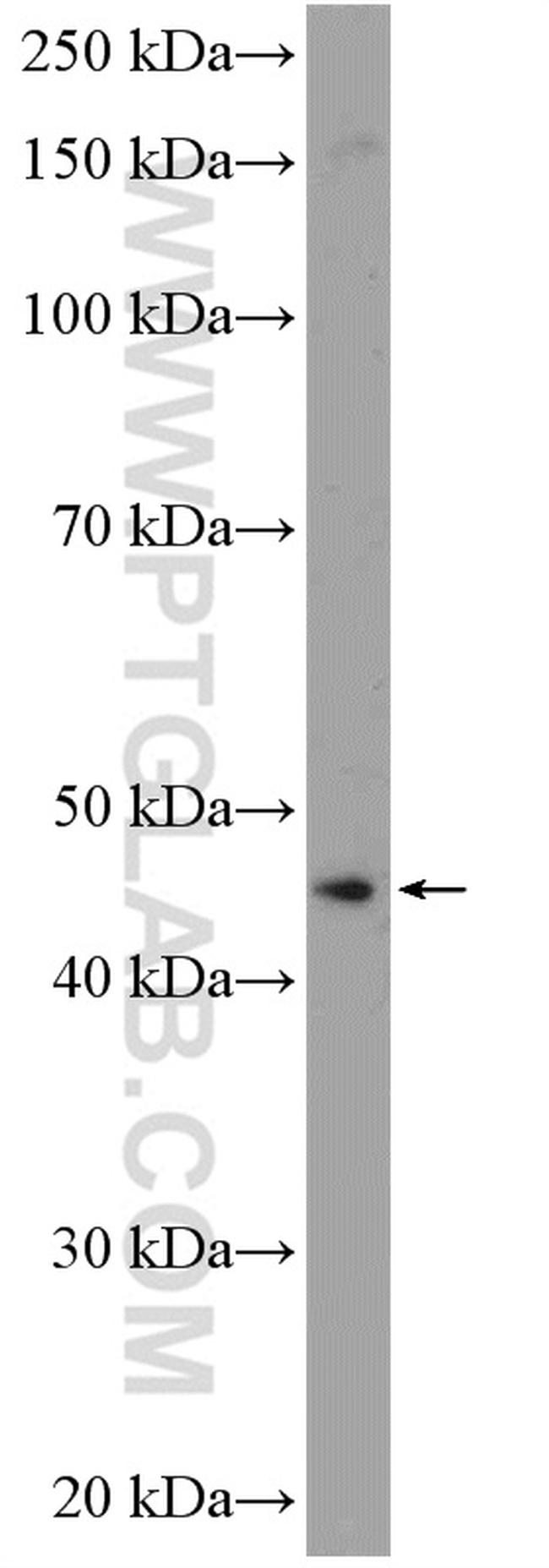 ANKRD16 Antibody in Western Blot (WB)