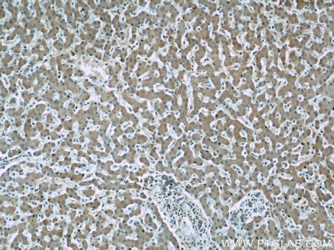 ERP29 Antibody in Immunohistochemistry (Paraffin) (IHC (P))