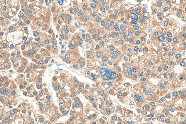 ERP29 Antibody in Immunohistochemistry (Paraffin) (IHC (P))