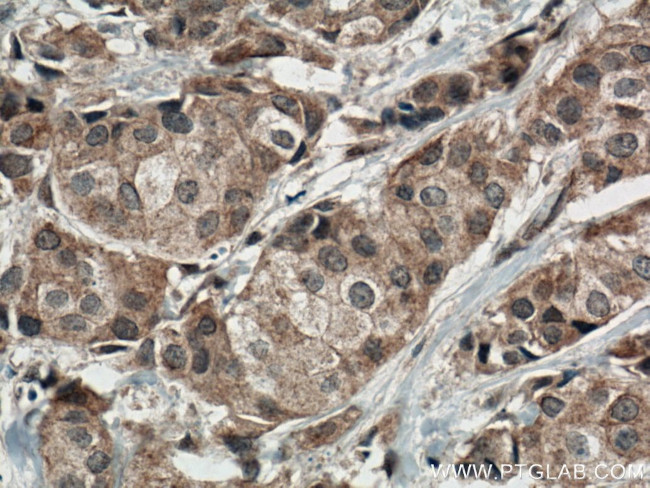 ACTN3 Antibody in Immunohistochemistry (Paraffin) (IHC (P))