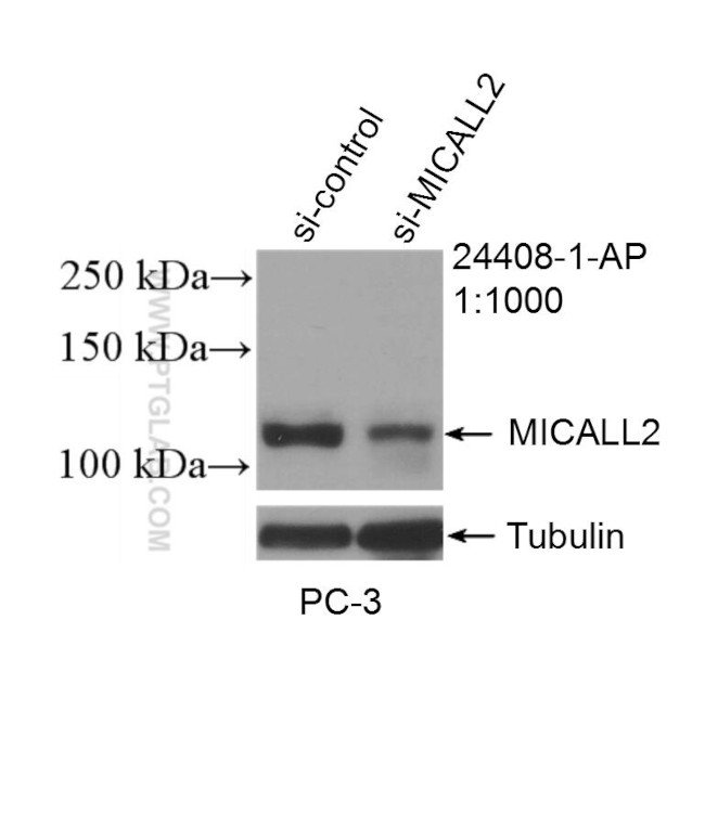 MICALL2 Antibody in Western Blot (WB)