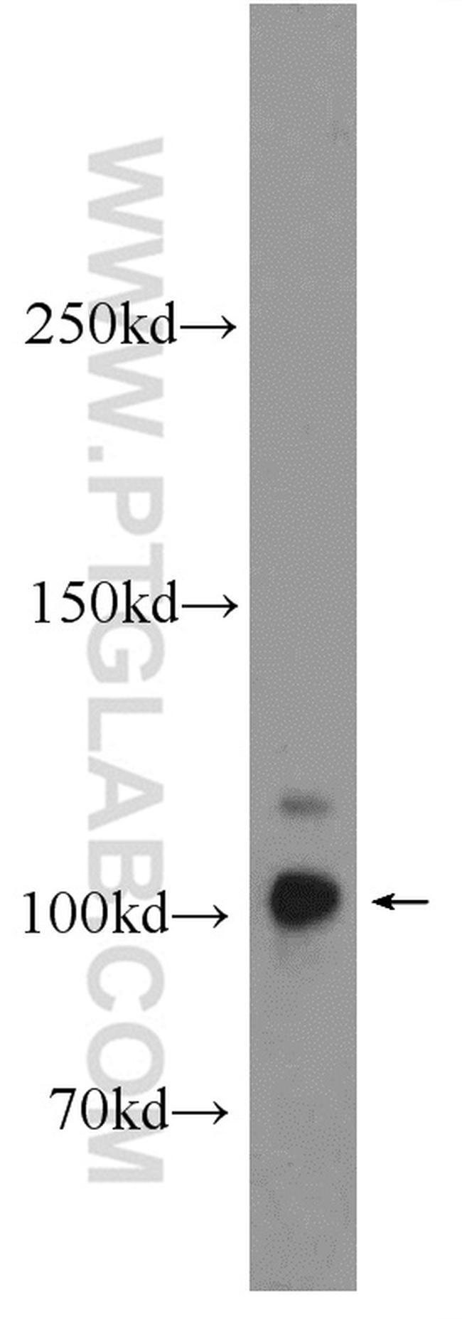 MICALL2 Antibody in Western Blot (WB)