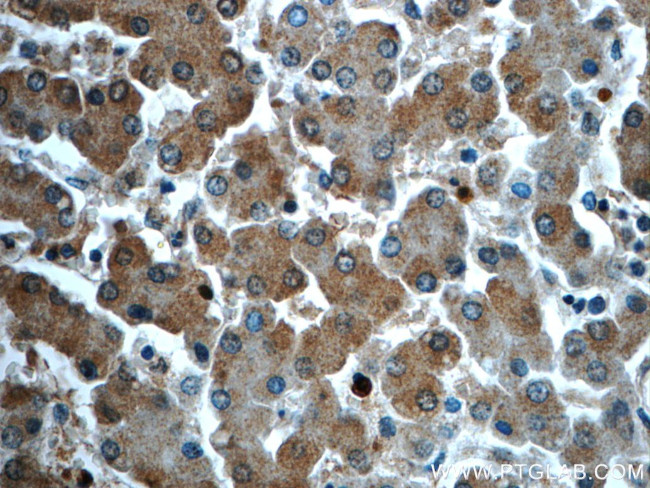 ATG14/Barkor (C-terminal) Antibody in Immunohistochemistry (Paraffin) (IHC (P))