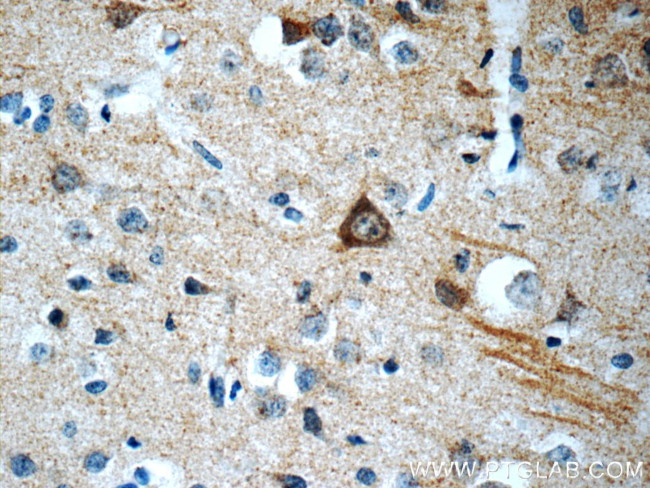 ATG14/Barkor (C-terminal) Antibody in Immunohistochemistry (Paraffin) (IHC (P))