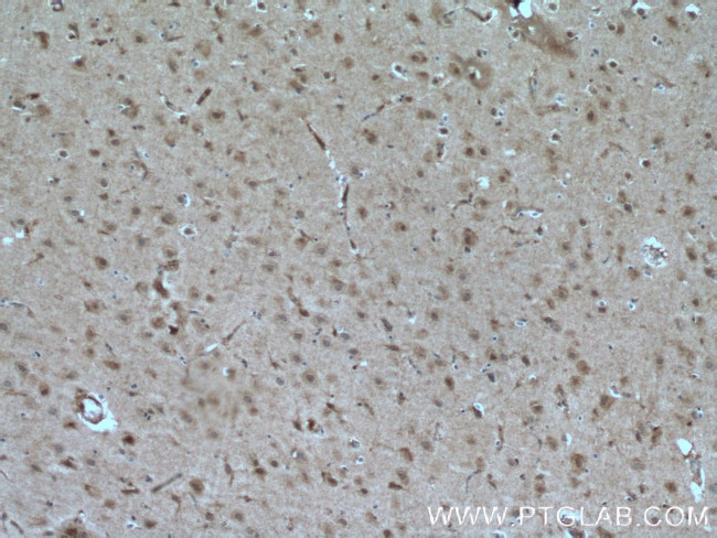 TALPID3 Antibody in Immunohistochemistry (Paraffin) (IHC (P))