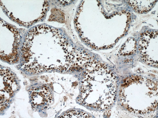 PRPF39 Antibody in Immunohistochemistry (Paraffin) (IHC (P))