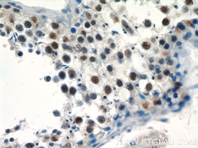 PRPF39 Antibody in Immunohistochemistry (Paraffin) (IHC (P))