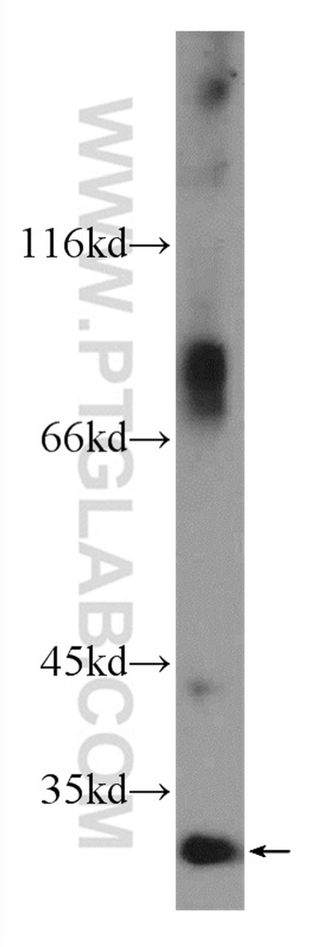 C16orf72 Antibody in Western Blot (WB)