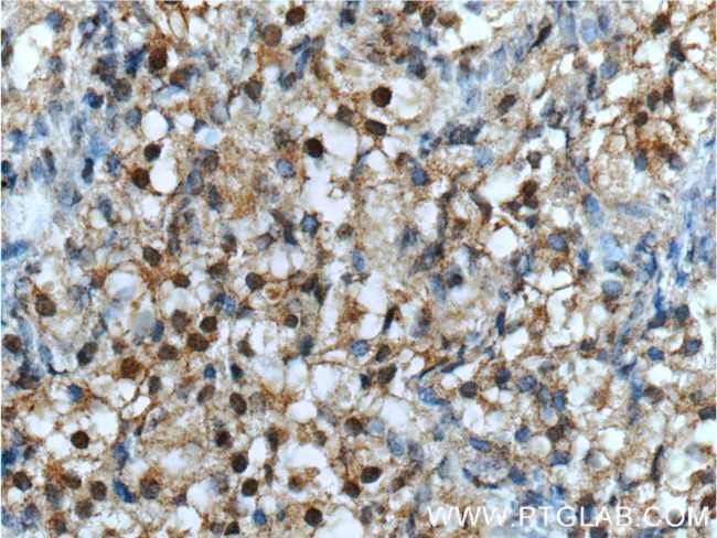 NR2F1 Antibody in Immunohistochemistry (Paraffin) (IHC (P))