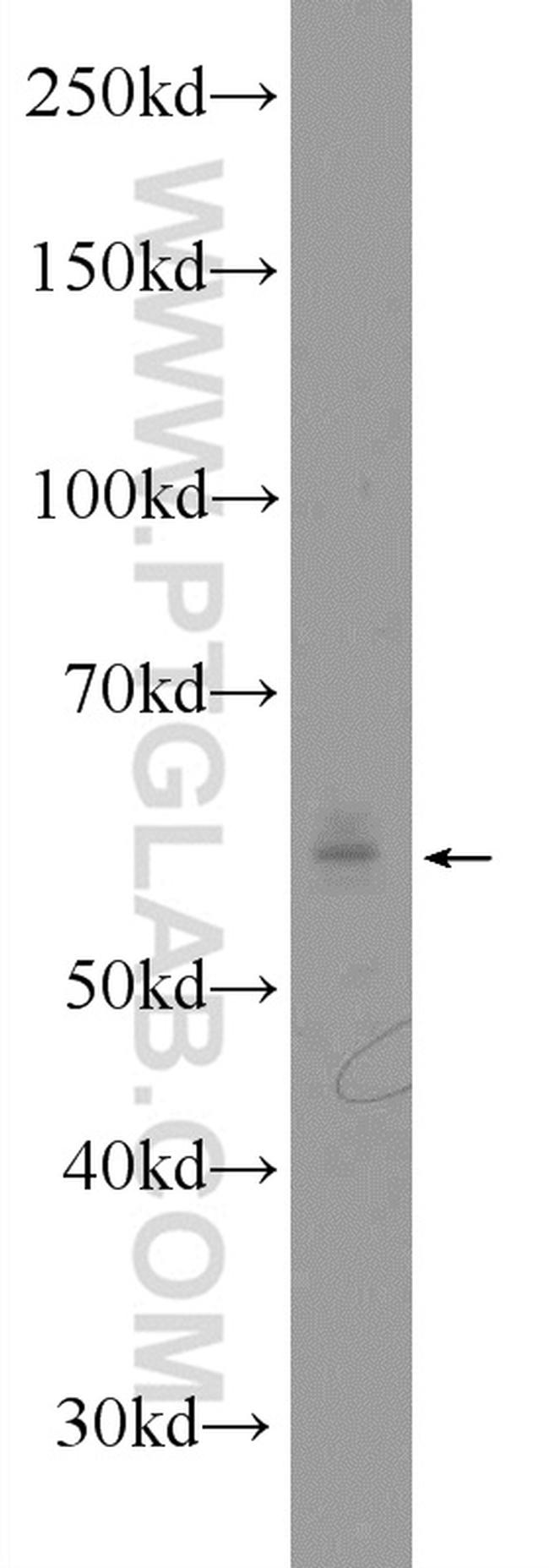 SLC37A1 Antibody in Western Blot (WB)