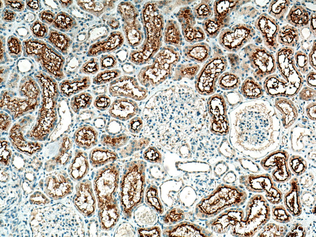 SLCO4C1 Antibody in Immunohistochemistry (Paraffin) (IHC (P))