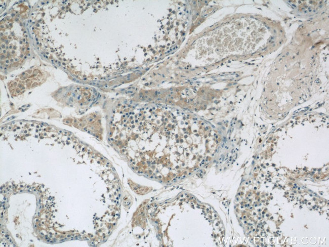 TEX15 Antibody in Immunohistochemistry (Paraffin) (IHC (P))