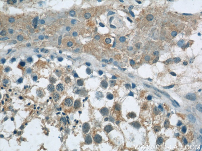 TEX15 Antibody in Immunohistochemistry (Paraffin) (IHC (P))