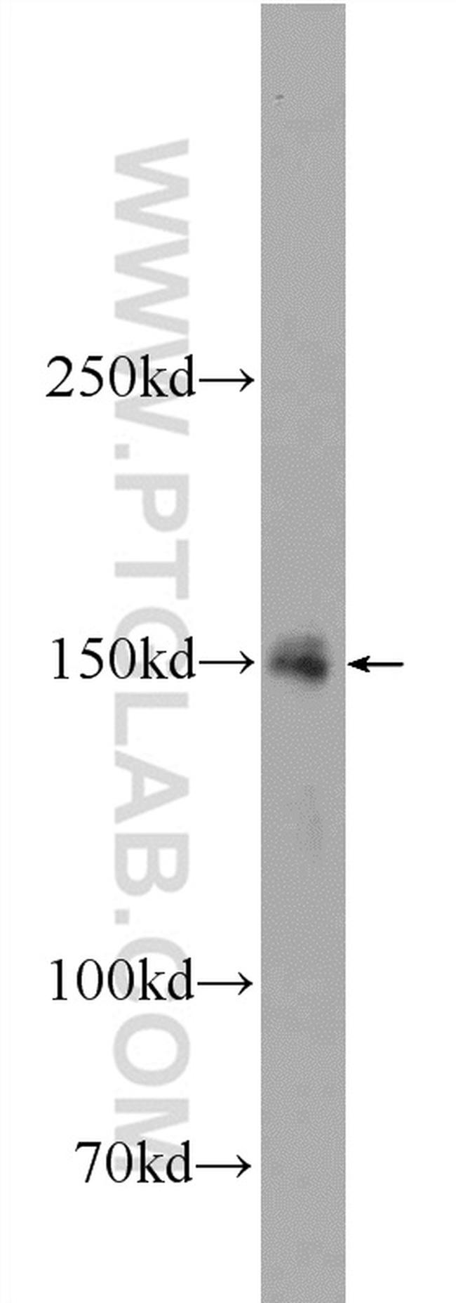 TEX15 Antibody in Western Blot (WB)