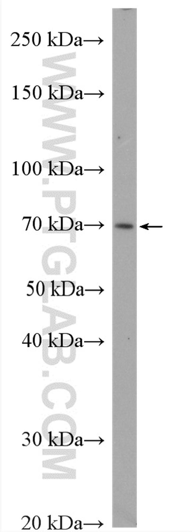 SORBS2 Antibody in Western Blot (WB)