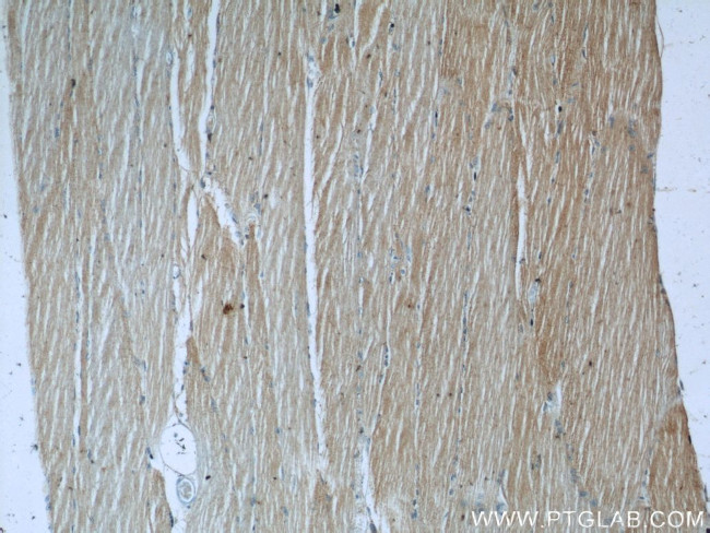 LRSAM1 Antibody in Immunohistochemistry (Paraffin) (IHC (P))