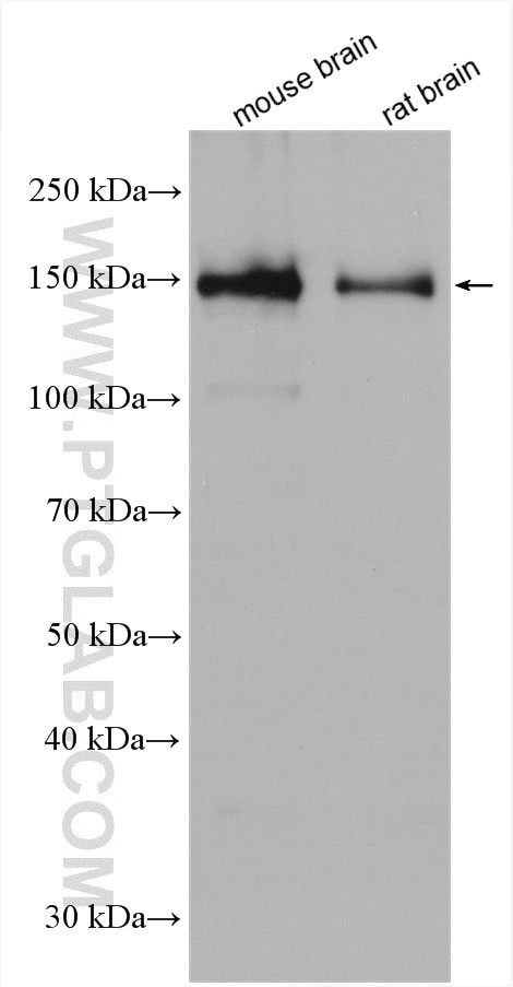 SYNJ1 Antibody in Western Blot (WB)