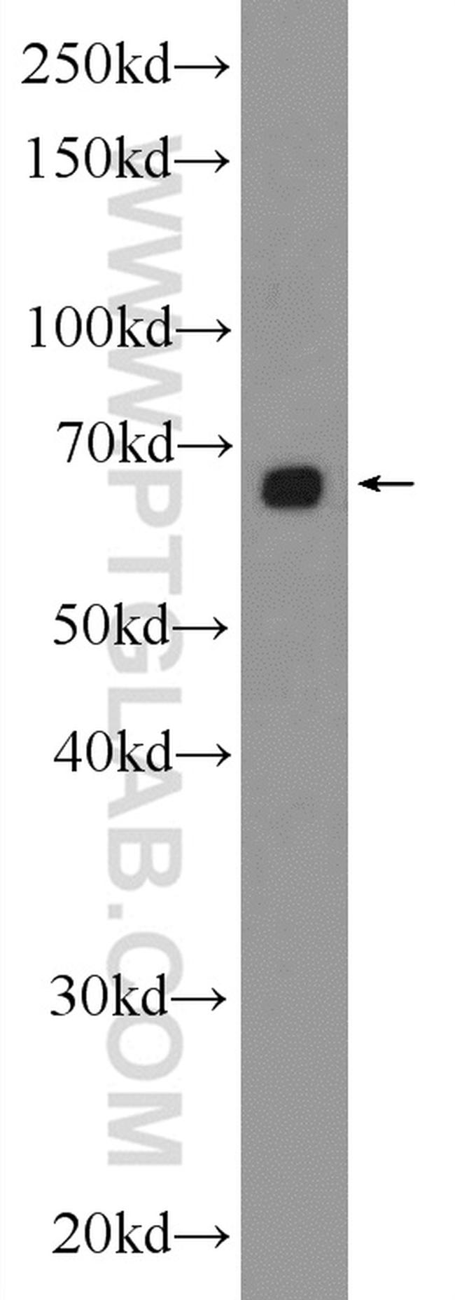 EYA4 Antibody in Western Blot (WB)