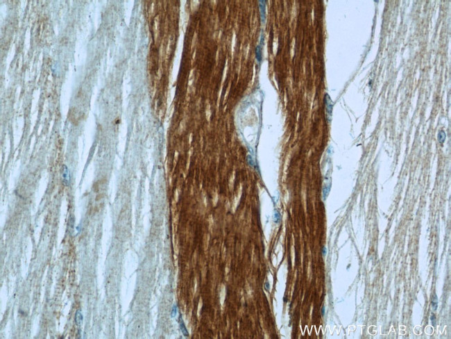 MN1 Antibody in Immunohistochemistry (Paraffin) (IHC (P))